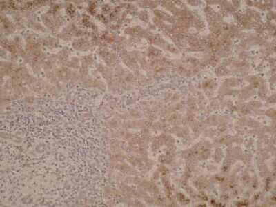 Immunohistochemistry: CYP51A1 Antibody (N6-P2H5*G8) - BSA Free [NBP2-50216]