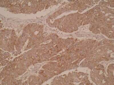 Immunohistochemistry: CYP51A1 Antibody (N6-P2H5*G8) - BSA Free [NBP2-50216]