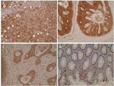 Immunohistochemistry-Paraffin: CYP7B1 Antibody (M17-P3F2) - BSA Free [NBP2-50217]