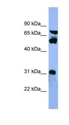 Western Blot: CYP8B1 Antibody [NBP1-68884]