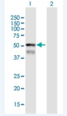 Western Blot: CYPIVF8 Antibody [H00011283-B01P-50ug]