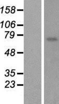 Western Blot: CYPIVF8 Overexpression Lysate [NBP2-10373]