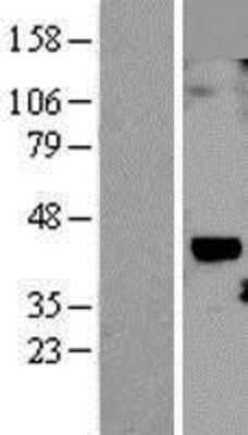 Western Blot: Cyr61/CCN1 Overexpression Lysate [NBL1-09705]