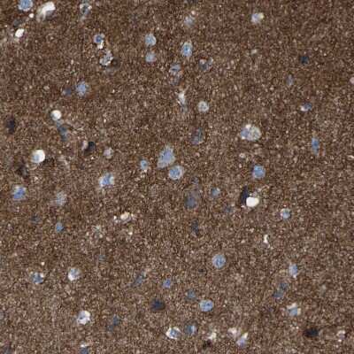 Immunohistochemistry-Paraffin: CYREN Antibody [NBP1-82120]