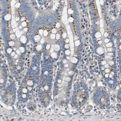 Immunohistochemistry-Paraffin: CYREN Antibody [NBP1-82120]