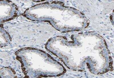 Immunohistochemistry-Paraffin: CYREN Antibody [NBP1-82120]