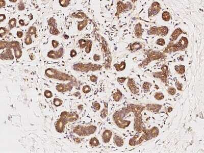 Immunohistochemistry-Paraffin: CYREN Antibody [NBP2-98664]