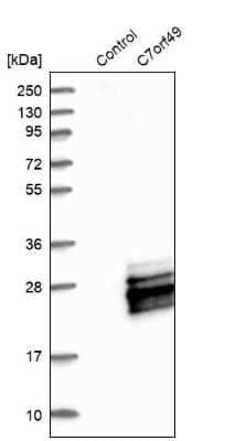 Western Blot: CYREN Antibody [NBP1-82120]