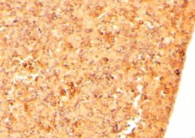 Immunohistochemistry-Paraffin: CYRPTIC/CFC1 Antibody [NB600-805]