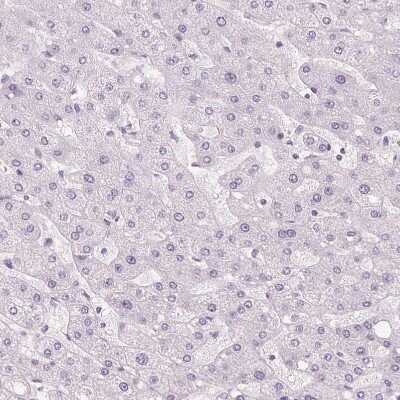 Immunohistochemistry-Paraffin: CYRPTIC/CFC1 Antibody [NBP2-14473]