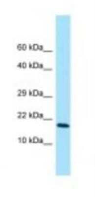 Western Blot: CYRPTIC/CFC1 Antibody [NBP1-98527]