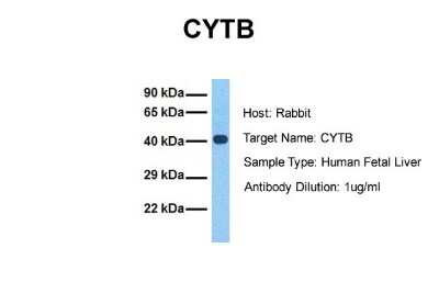 Western Blot: CYTB Antibody [NBP1-79340]