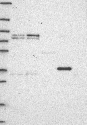 Western Blot: CYTB Antibody [NBP3-17828]