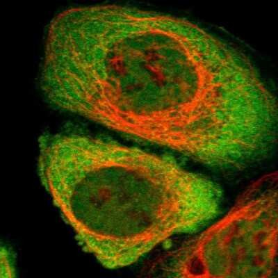 Immunocytochemistry/ Immunofluorescence: CYTIP Antibody [NBP1-88946]