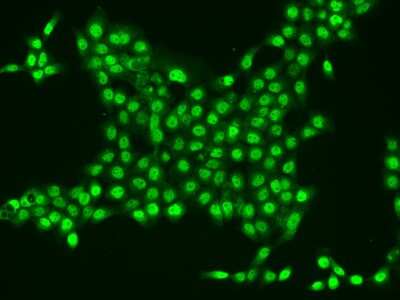 Immunocytochemistry/ Immunofluorescence: CYTIP Antibody [NBP2-97434]