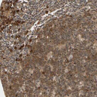 Immunohistochemistry-Paraffin: CYTIP Antibody [NBP1-88946]