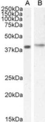 Western Blot: CYTIP Antibody [NB100-1002]