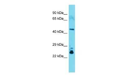 Western Blot: CYTIP Antibody [NBP2-84751]