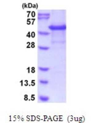 SDS-PAGE: Recombinant Human CYTIP His Protein [NBP2-51974]