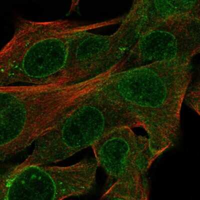 Immunocytochemistry/ Immunofluorescence: CYTL1 Antibody [NBP2-68851]