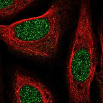 Immunocytochemistry/ Immunofluorescence: CYYR1 Antibody [NBP2-49526]