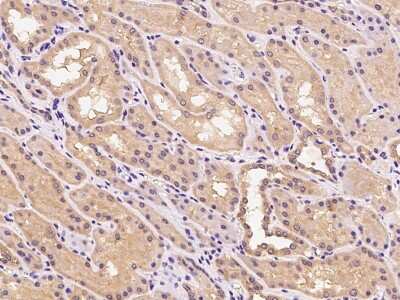 Immunohistochemistry-Paraffin: CYYR1 Antibody [NBP2-99241]