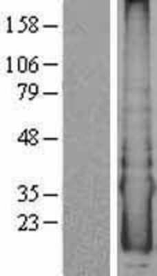 Western Blot: CYYR1 Overexpression Lysate [NBL1-09707]