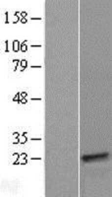 Western Blot: TXLNGY Overexpression Lysate [NBP2-08852]