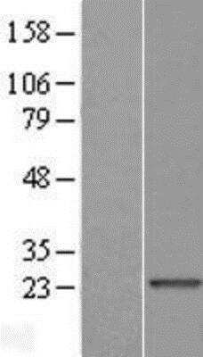 Western Blot: TXLNGY Overexpression Lysate [NBP2-05998]