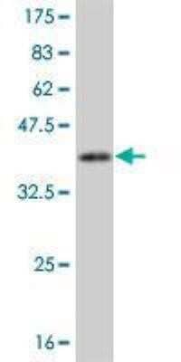 Western Blot: CaM Kinase I Antibody (2B6) [H00008536-M02]