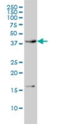 Western Blot: CaM Kinase I Antibody (3G1) [H00008536-M01]