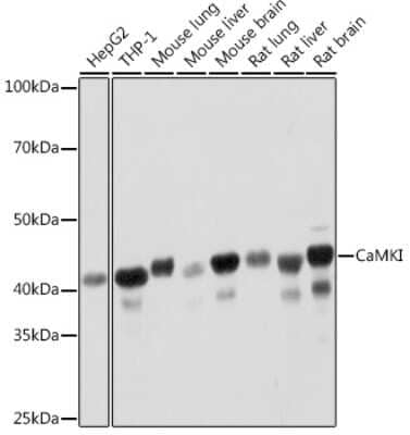 Western Blot: CaM Kinase I Antibody (4P4K9) [NBP3-16210]