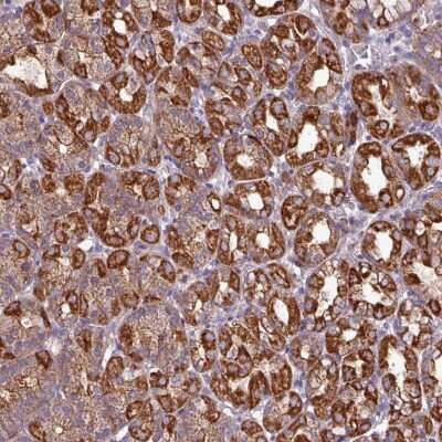 Immunohistochemistry: CaM Kinase I Antibody [NBP2-38647]