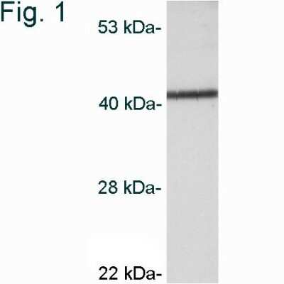 Western Blot: CaM Kinase I Antibody [NB600-1163]