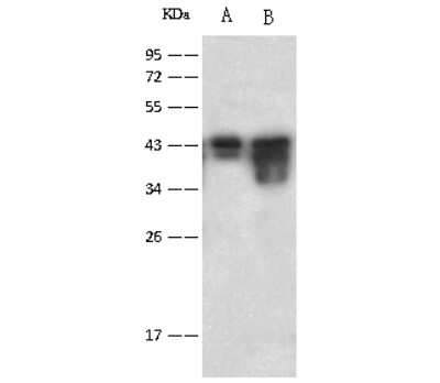 Western Blot: CaM Kinase I Antibody [NBP2-99439]