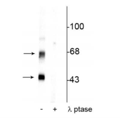 Western Blot: CaM Kinase II [p Thr306] Antibody [NBP2-60767]