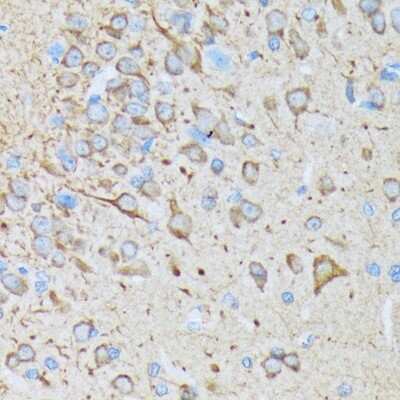 Immunohistochemistry-Paraffin: CaM Kinase II Antibody (9P2E2) [NBP3-15256]