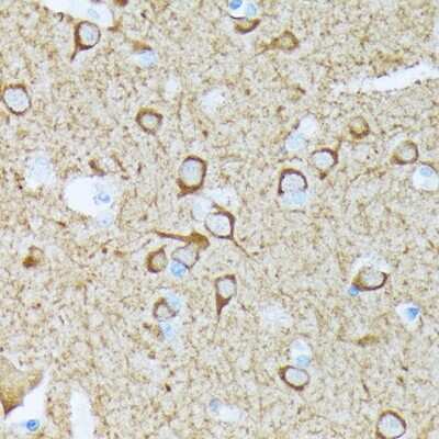 Immunohistochemistry-Paraffin: CaM Kinase II Antibody (9P2E2) [NBP3-15256]