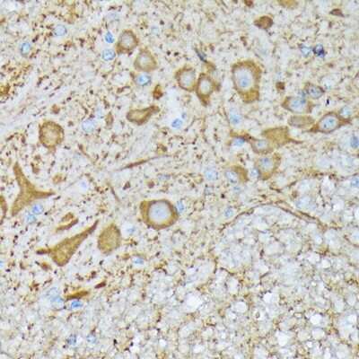 Immunohistochemistry-Paraffin: CaM Kinase II Antibody (9P2E2) [NBP3-15256]