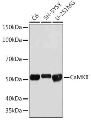 Western Blot: CaM Kinase II Antibody (9P2E2) [NBP3-15256]