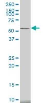 Western Blot: CaM Kinase II alpha Antibody (2C4) [H00000815-M01]