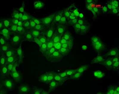 Immunocytochemistry/ Immunofluorescence: CaM Kinase II alpha Antibody (6G9) [NB100-1983]