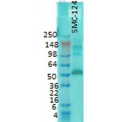 Western Blot: CaM Kinase II alpha Antibody (6G9) [NB100-1983]