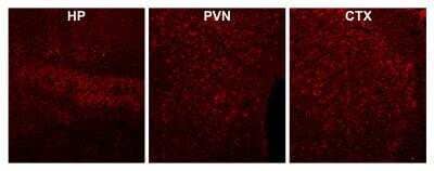 Immunohistochemistry: CaM Kinase II alpha Antibody [NBP1-51945]