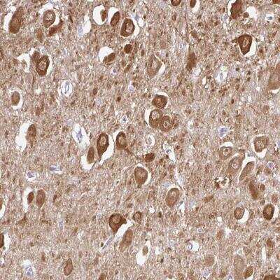 Immunohistochemistry-Paraffin: CaM Kinase II alpha Antibody [NBP2-46821]