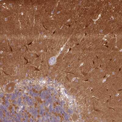 Immunohistochemistry-Paraffin: CaM Kinase II alpha Antibody [NBP2-46795]