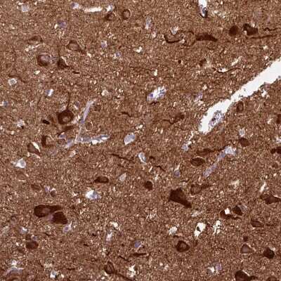 Immunohistochemistry-Paraffin: CaM Kinase II alpha Antibody [NBP2-46795]