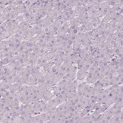 Immunohistochemistry-Paraffin: CaM Kinase II alpha Antibody [NBP2-46795]
