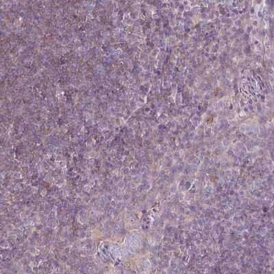 Immunohistochemistry-Paraffin: CaM Kinase II alpha Antibody [NBP2-46795]