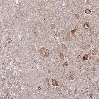 Immunohistochemistry-Paraffin: CaM Kinase II alpha Antibody [NBP2-46796]